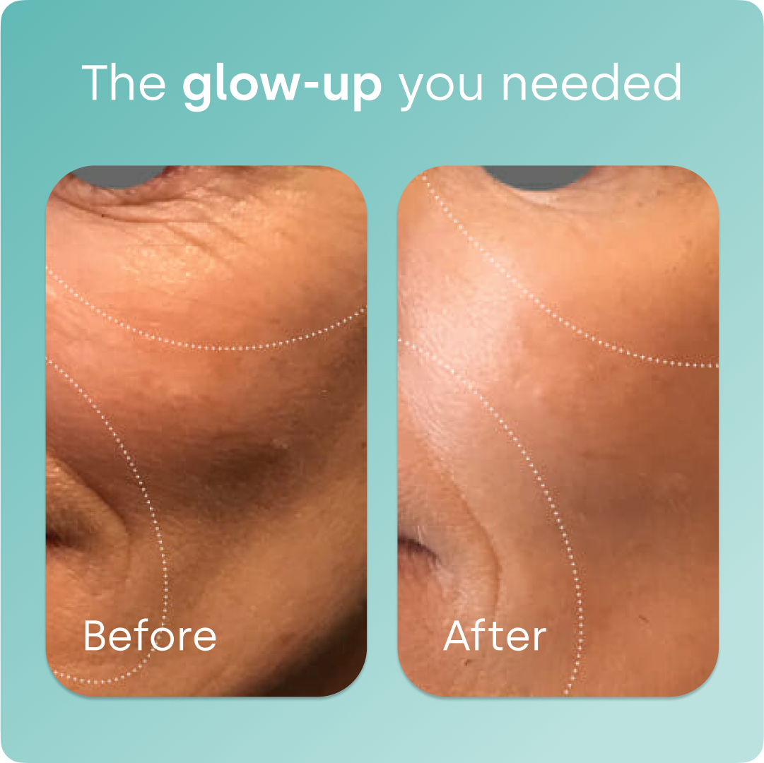 Biosil® Collagen Generator Capsules