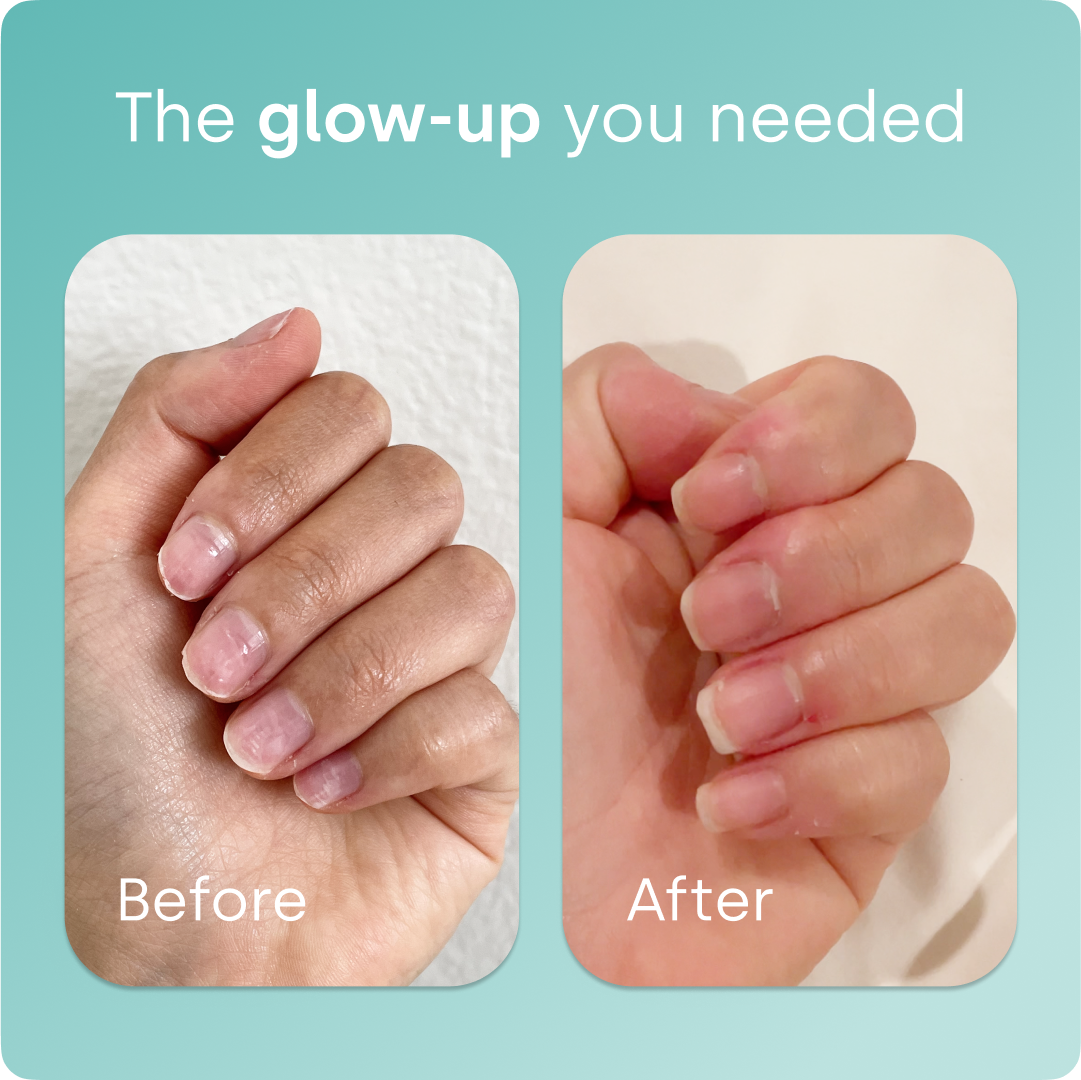 Biosil® Collagen Generator Capsules