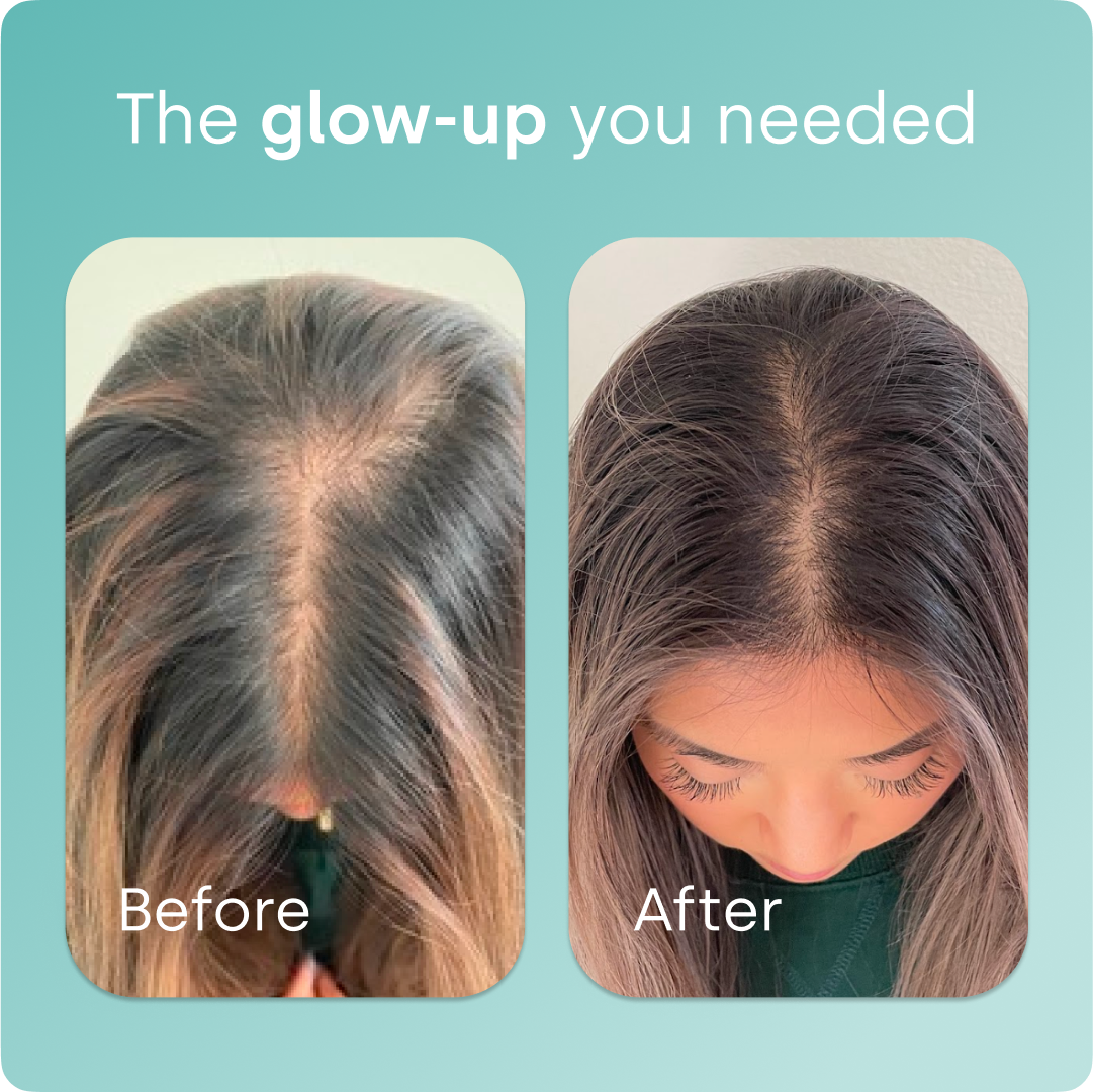 Biosil® Collagen Generator Capsules