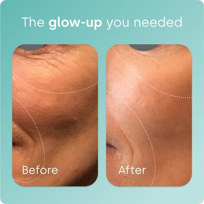 Biosil® Collagen Generator Capsules