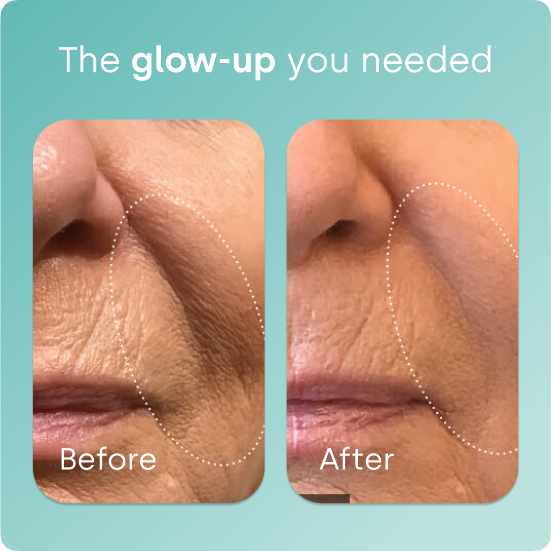 Biosil® Collagen Generator Capsules