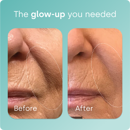Biosil® Collagen Generator Capsules