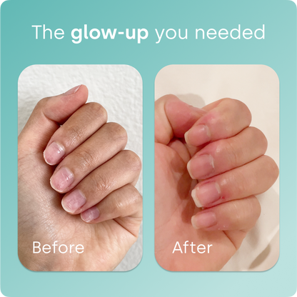 Biosil® Collagen Generator Capsules