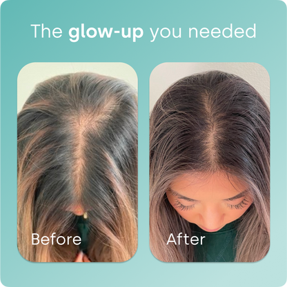 Biosil® Collagen Generator Capsules
